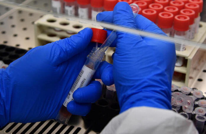 Coronavirus: fase 2, laboratorio dedicato agli esami Covid-19 a Genova