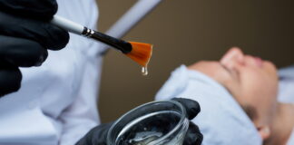 trattamento peeling chimico a Salerno