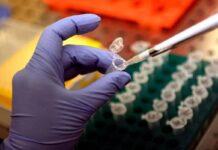Morbillo, Pennsylvania segnala sesto morto: 39enne con patologie e già infettata di recente