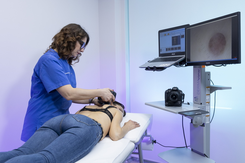 mappatura nei prevenzione melanoma