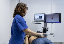 prevenzione del melanoma