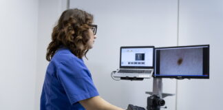 prevenzione del melanoma