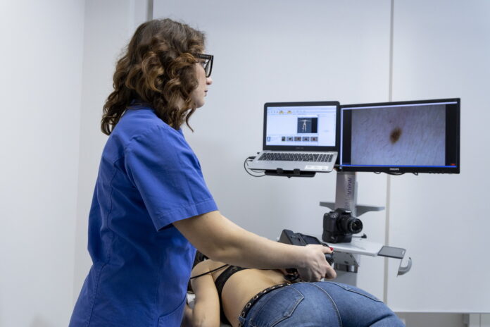 prevenzione del melanoma