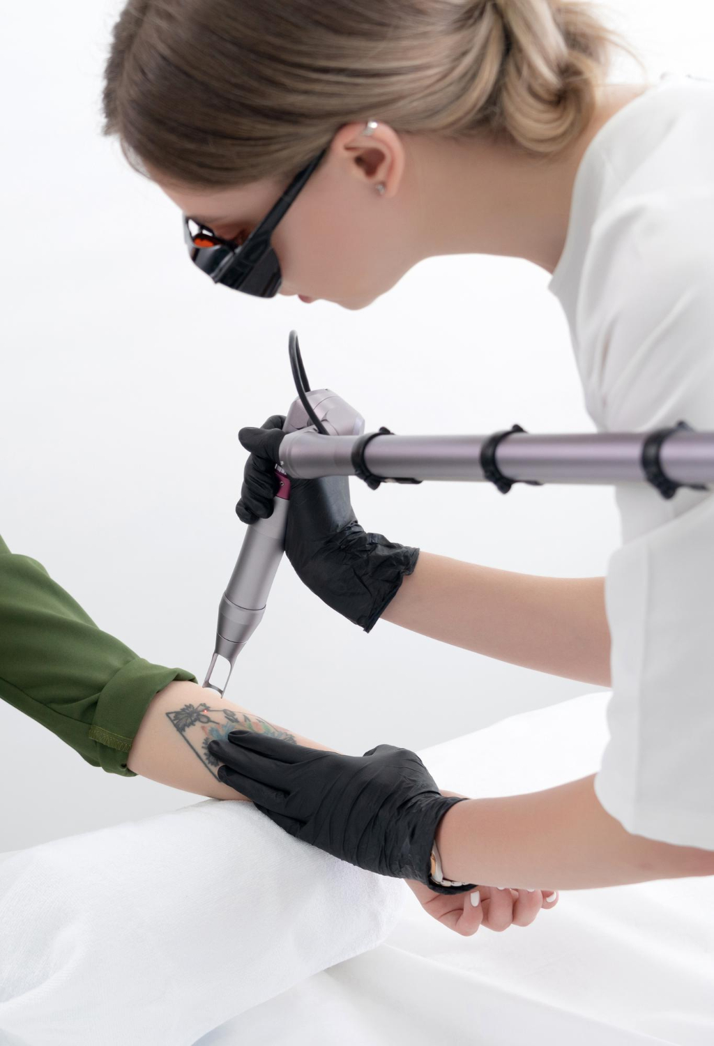 rimozione tatuaggi salerno